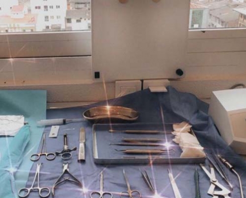 متخصص ایمپلنت در رشت - جراحی لثه در رشت - دکتر شهرام جلیل زاده