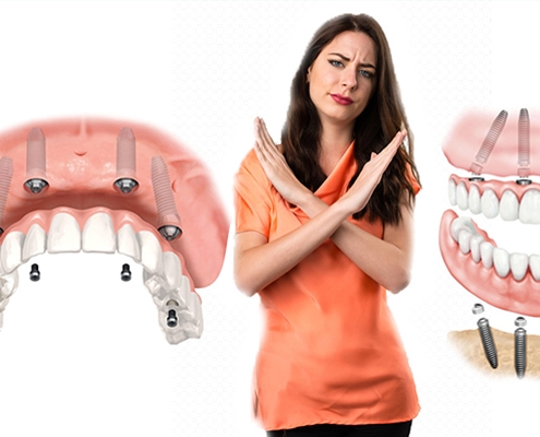 عوارض ایمپلنت دندان چیست؟ - معایب دندان های ایمپلنت - دکتر شهرام جلیل زاده - متخصص ایمپلنت در رشت