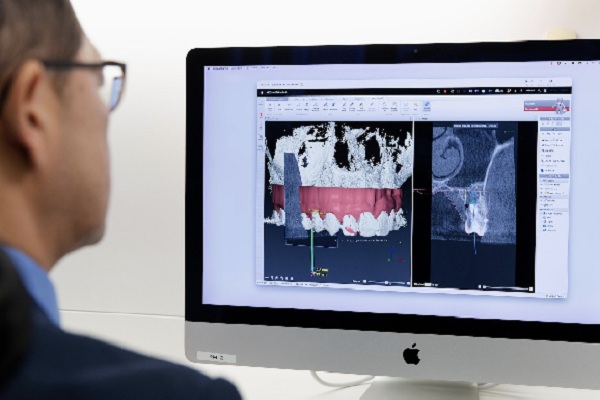 ایمپلنت دیجیتال دندان